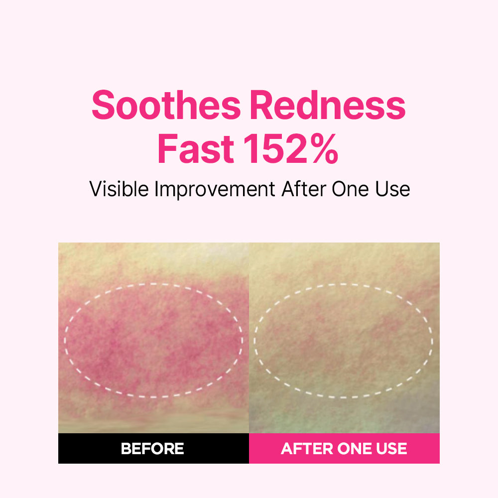 Blemish Care Up Serum